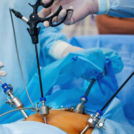 Advanced laparoscopic Urology in Abu Dhabi