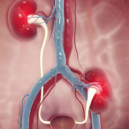 Renal Transplantation in Abu Dhabi